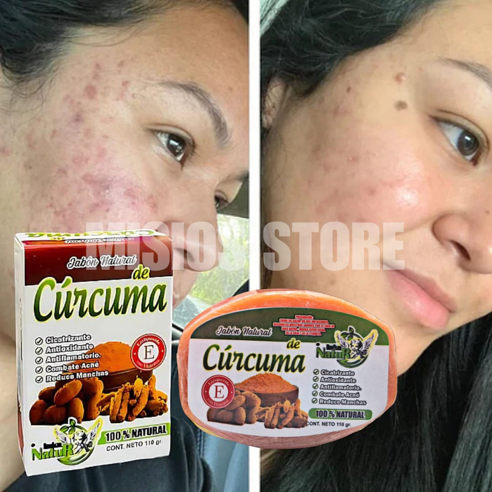 MASAJEADOR FACIAL LED + JABON DE CURCUMA