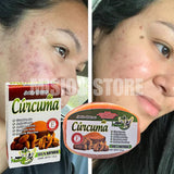 MASAJEADOR FACIAL LED + JABON DE CURCUMA